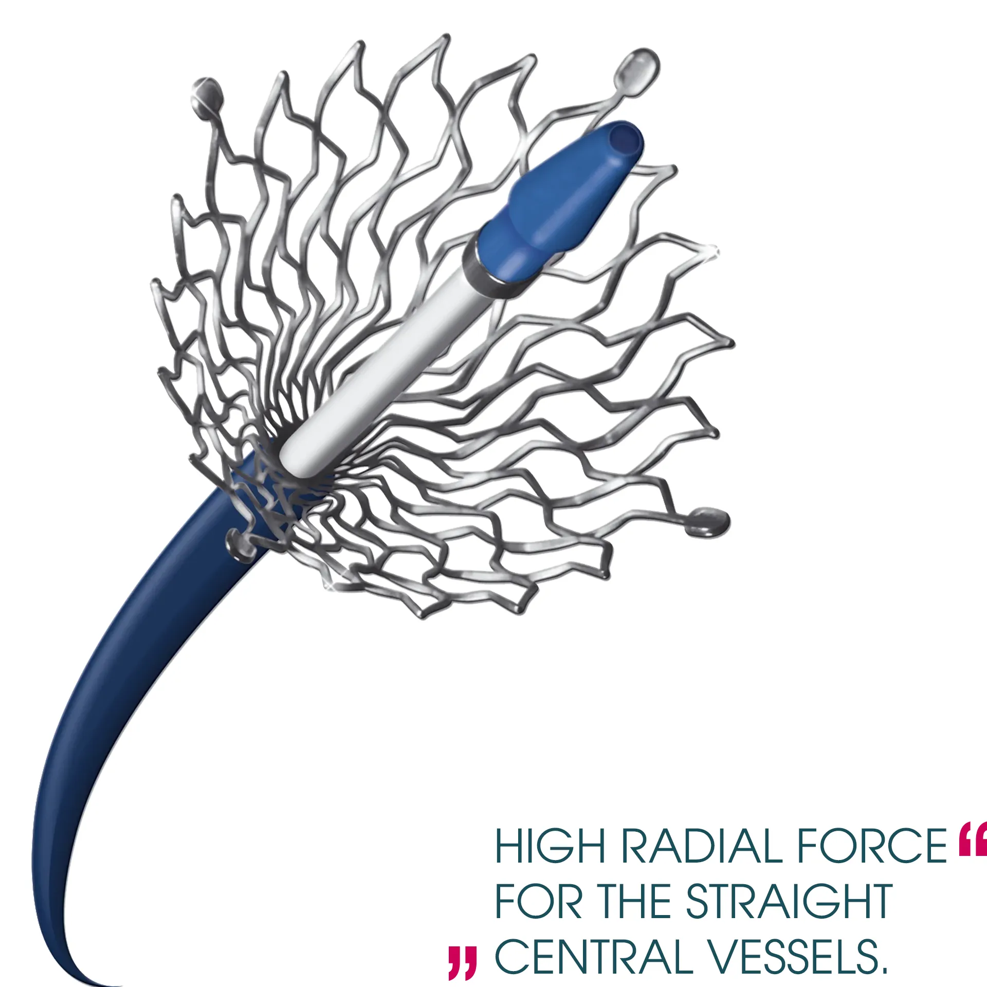 Stent-EFB